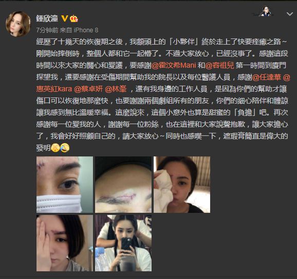 阿娇额头受伤严重吗？阿娇晒受伤额头照透露将痊愈-第1张图片-芙蓉之城